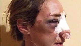 El calvario de una mujer: “Se calmaba, lloraba y después volvía con más piñas”